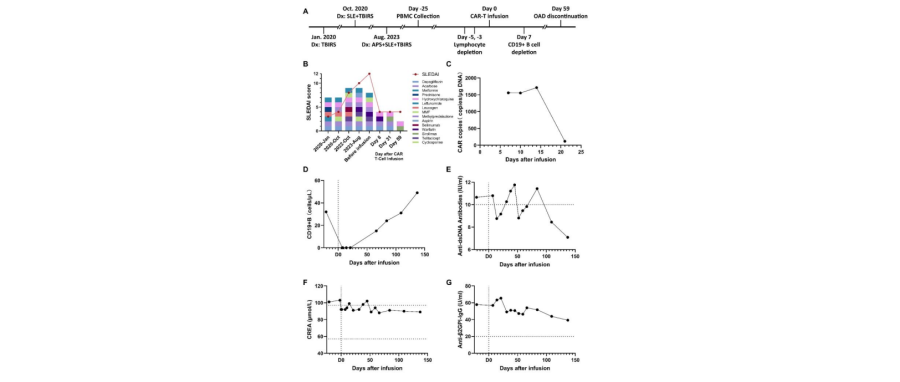 Good News|CD19 CAR-T Therapy for SLE+APS+TBIRS,  